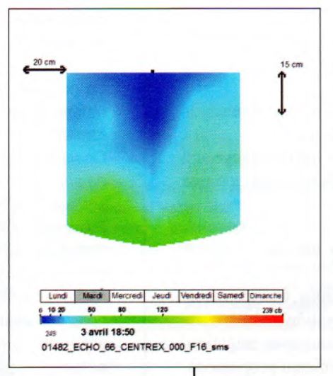 Irrigation goutte à goutte : echographie du bulbe